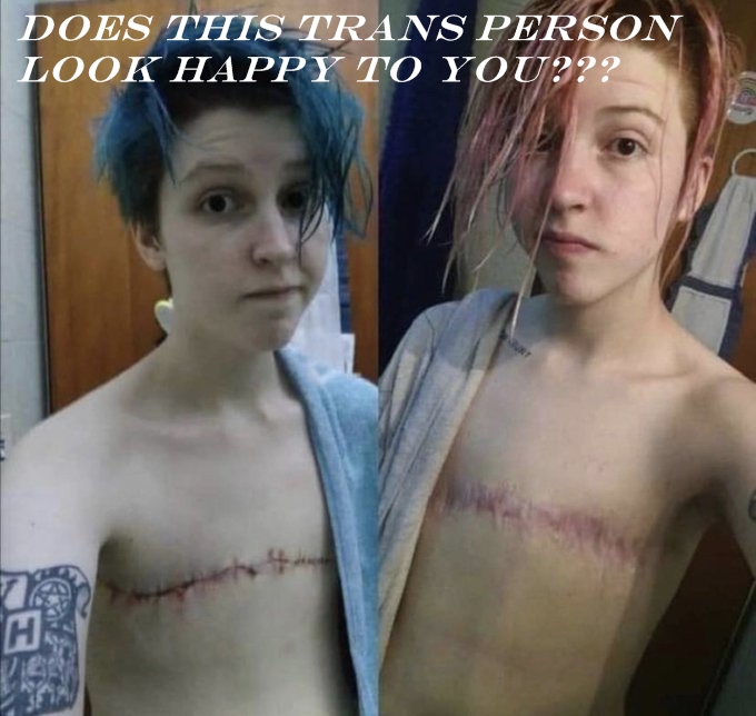 Maximil86429959's tweet photo. Roderic O'Gorman, Ireland's ideological and childless Minister for Children has absolutely no problem with this kind of despicable and irreversible mutilation of young peoples bodies, in fact, he actively promotes this damaging ideology! #ResignRodericOGorman https://t.co/1Elg8YfeAY
