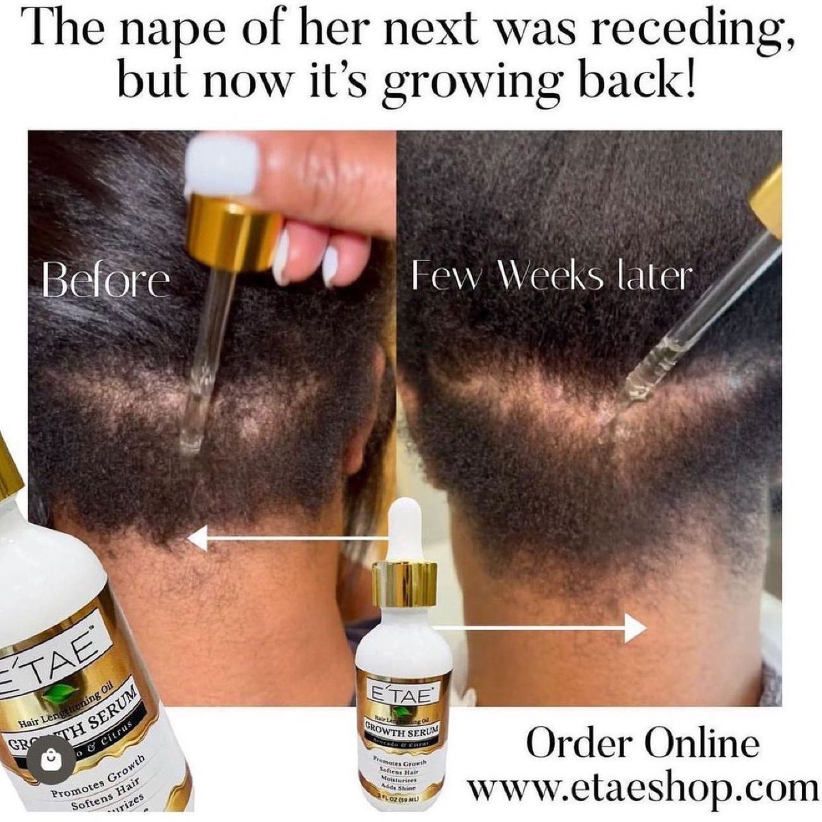 etaeshop.com/products/lengt…