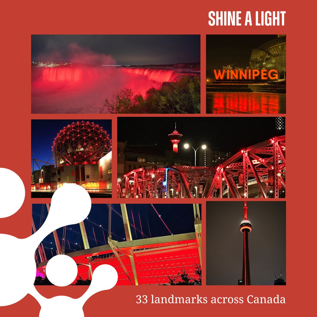 defeatduchenne's tweet photo. As the sun sets on World Duchenne Awareness Day, 33 landmarks will shine bright across #Canada to show solidarity with the #Duchenne and #Becker #musculardystrophy community: https://t.co/MXBqlMaior.

📸 Take a picture and tag #WDAD2023 @defeatduchenne @worldduchenne https://t.co/LEngRljM9x