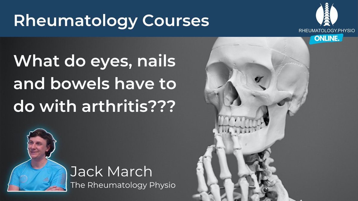 physiojack's tweet photo. It's #WorldPTDay all about inflammatory arthritis

Why not check out some of the work I have been doing for the last 7 years (ish) about these conditions!

Find everything here: https://t.co/YJ0qGfpTK9 https://t.co/hF9teFfAfA