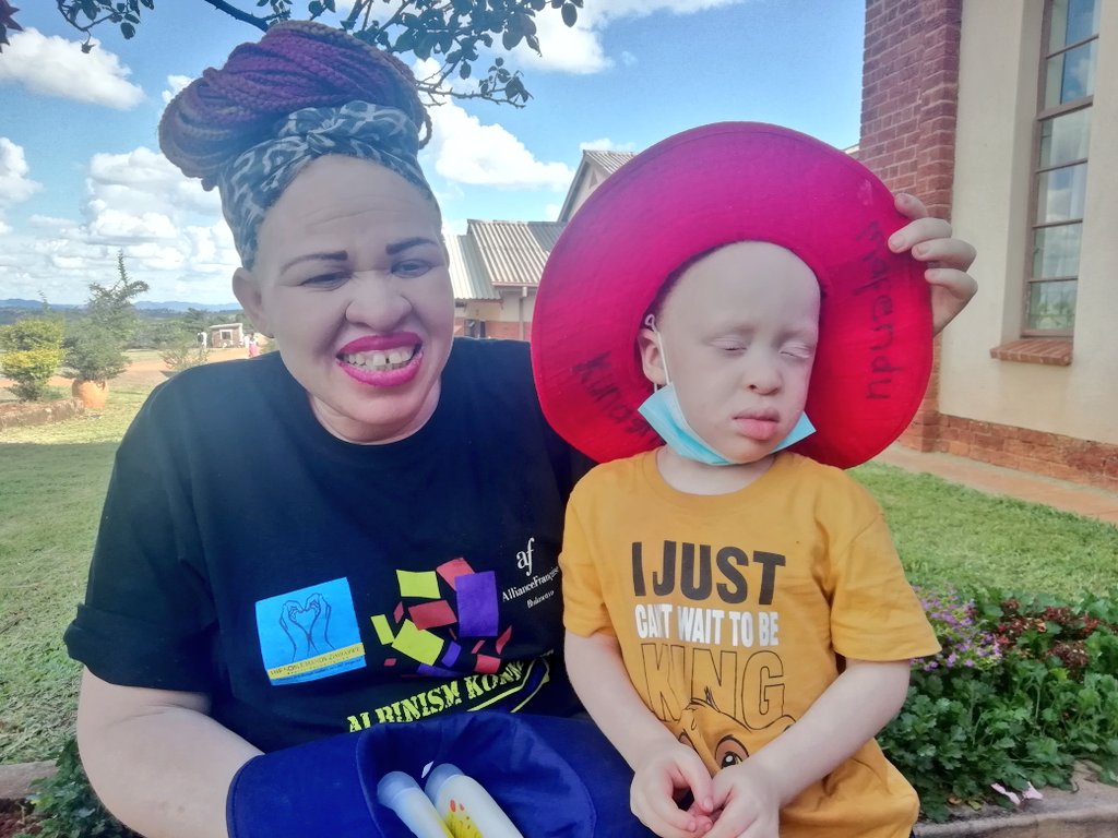 TNHZ_Trust's tweet photo. Did you know, there are are 5 types of albinism namely
☑️Ocular Albinism
☑️Oculocuteneous Albinism
☑️Chediak-Higashi Syndrome
☑️Pudlak Syndrome
☑️Gricelli Syndrome

In Zimbabwe Oculocuteneous Albinism is the most common type of Albinism.
A very good morning to you 🇿🇼 https://t.co/L1jUHKznUg