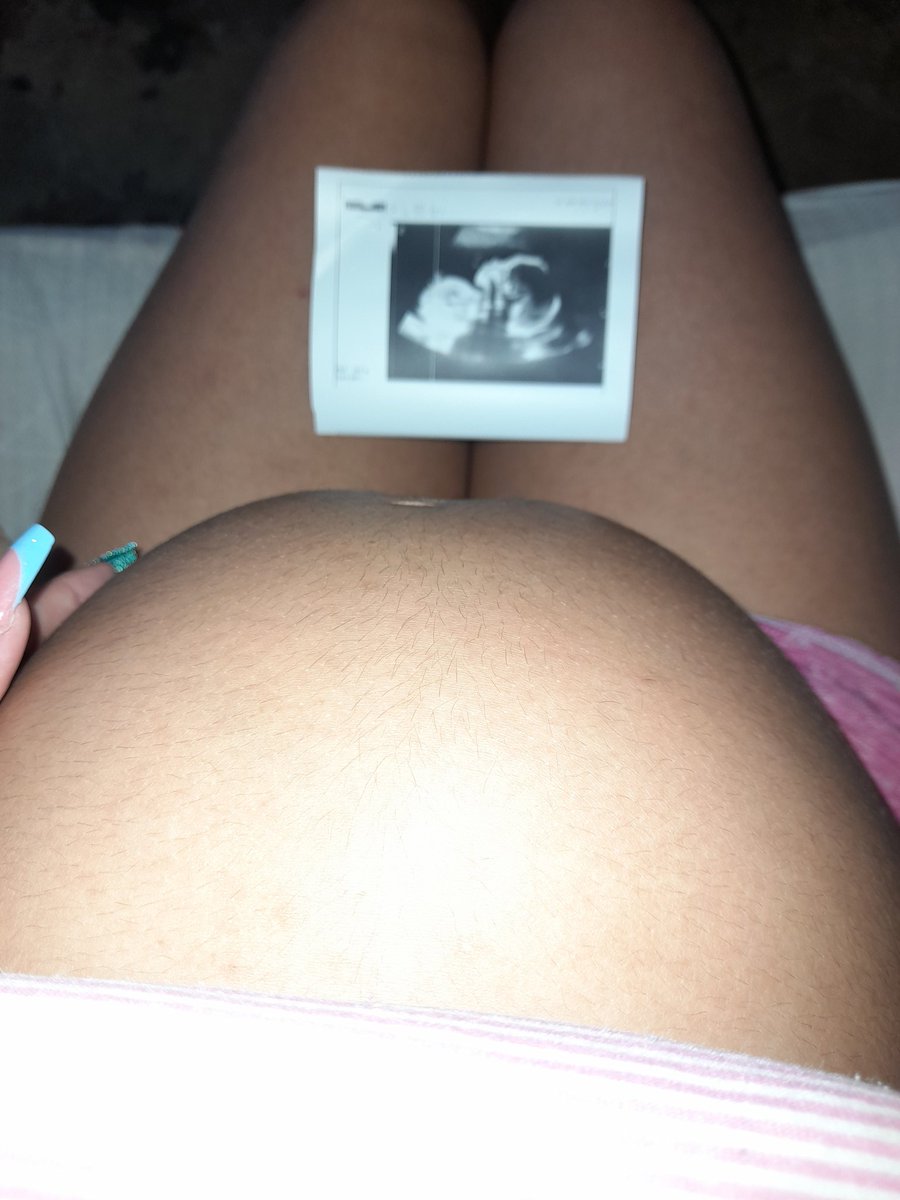 a 1 semana y entramos a los 9 meses y mi pancita super linda🤭😍😍😍