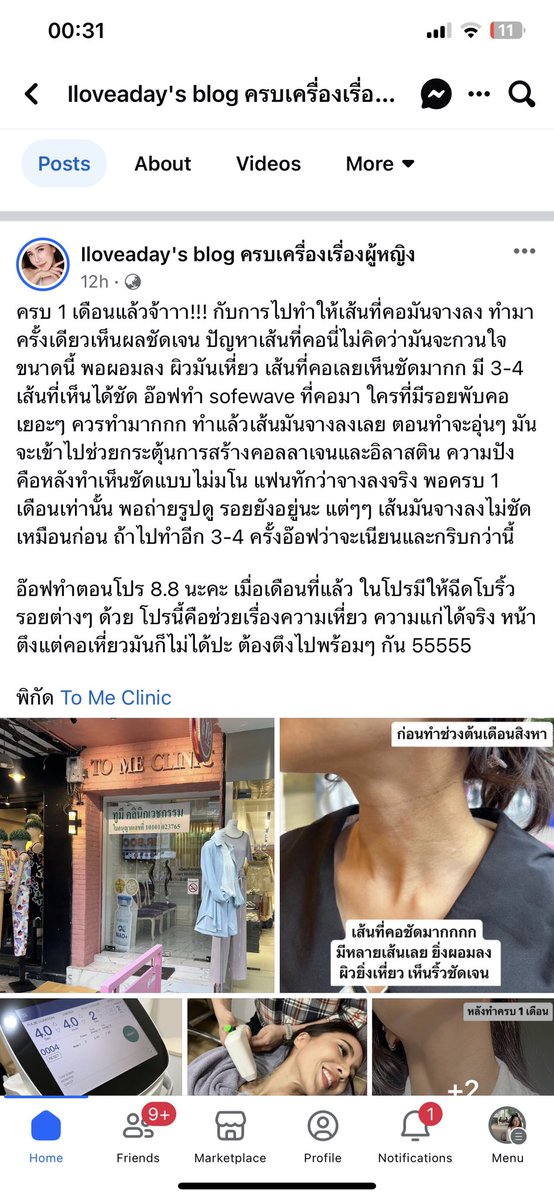 weiwor1234's tweet photo. ดีนะแคปทันอเมริกา ตอนแรกลงรูปหน้าจอเครื่อง พอเราทักไปถามคลินิกว่าเครื่องแท้รึเปล่า ราคาถูกกว่าคลินิกที่ทำมาก โพสนี้ก็ลบรูปหน้าจอเครื่องไปเลยอ่ะค่ะ  มีพิรุธนะ https://t.co/korEoTXucL