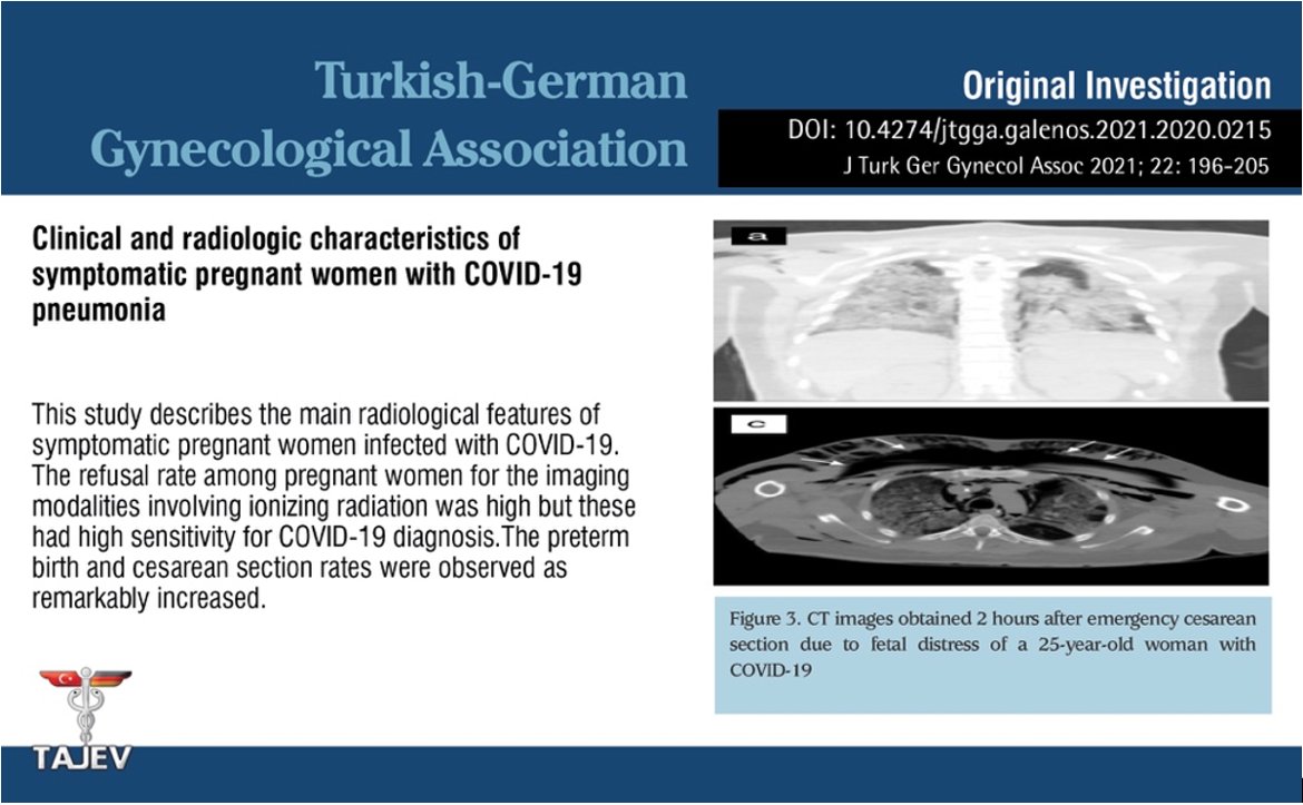 JtggaOfficial's tweet image. Clinical and radiologic characteristics of symptomatic pregnant women with COVID-19 pneumonia

You can see the free full text of the research by Taha Yusuf Kuzan et al.

Link : cms.galenos.com.tr/Uploads/Articl…

#COVID19 #pregnancy #computed #tomography #chest #radiography #radiolog
