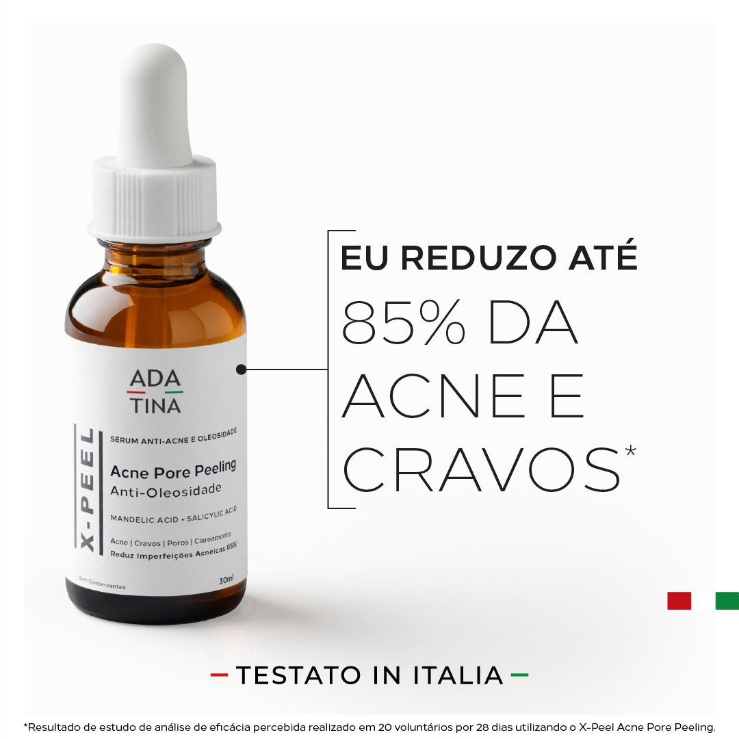 ADATINA's tweet photo. Problemas com acne e cravos? 😉

Conheça o peeling clareador antiacne em serum: X-Peel Acne Pore Peeling! ✨

Além disso, possui testes de eficácia com resultados que irão te surpreender:

• 85% Reduz Acne e Cravos e Poros Abertos;
• 85% Previne Surgimento de Novas Acnes e Cravos;
• 85% Controle do Brilho e da Oleosidade;
• 95% Reduz Imperfeições;
• 90% Pele mais Clara e Iluminada;
• 85% Reduz Imperfeições Acneicas;
• 85% Uniformiza a Pele.

Saiba mais sobre: https://t.co/M1gJ6amYhZ

#adatina #skincare #skin #saúde #pele #cuidadoscomapele #tratamento #cosmético #dermocosmético #peeling #antiacne #peleoleosa #peleacneica #acne #espinha #cravo #anticravo