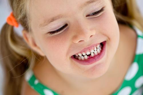 RiiliStudio's tweet photo. Il bambino, tra i 6 e i 12 anni, attraversa e completa la perdita progressiva dei denti da latte e la comparsa dei denti permanenti. E' quindi opportuno che venga regolarmente osservato dal Dentista almeno una volta all’anno.
#Dentizione 
#StudioDentisticoRiili
#ANDI
#Siracusa https://t.co/b7a2c9yUke