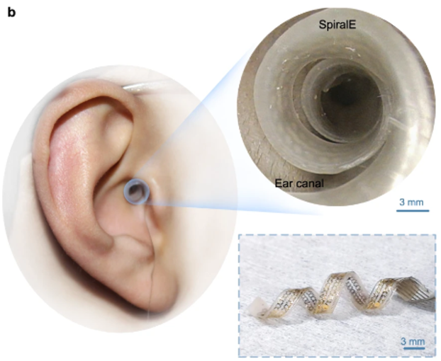 A new In-ear #bioelectronic, SpiralE, may potentially revolutionize #regenerative medicine as it can avoid invasive and inconvenient form factors while maintaining the desired functionality of similar devices, such as language rehab and assistance. More: bit.ly/44b9tZo