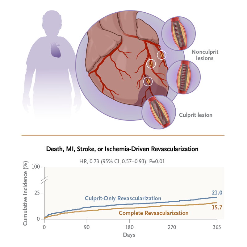 NEJM's tweet photo. In young and middle-aged patients with myocardial infarction and multivessel coronary artery disease, the benefits of pursuing complete revascularization — by treating nonculprit lesions as well as culprit lesions — are well established.
Full FIRE trial Research Summary:
