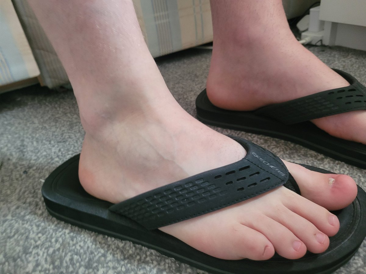 Boy95Vers's tweet photo. My feet in flip-flops 😛 https://t.co/z5F5ssO0Ym