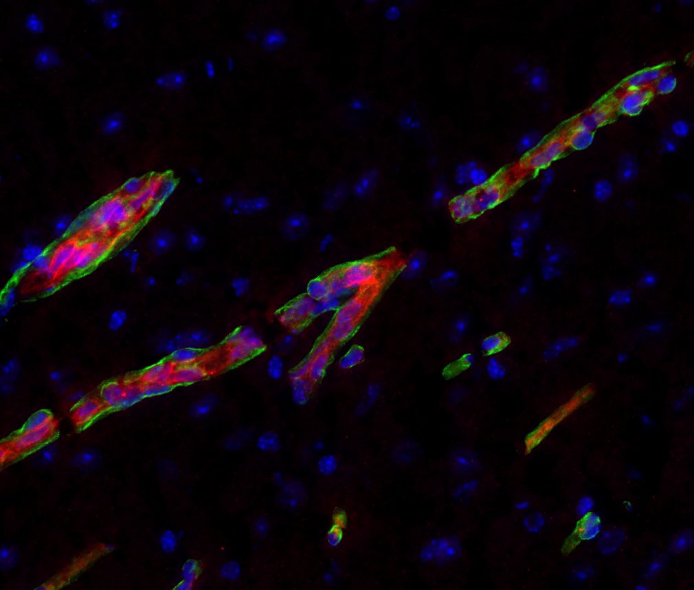 #BloodBrainBarrier staining 

Claudin5 🔴 Aquaporin4🟢 Dapi🔵

#FluorescenceFriday