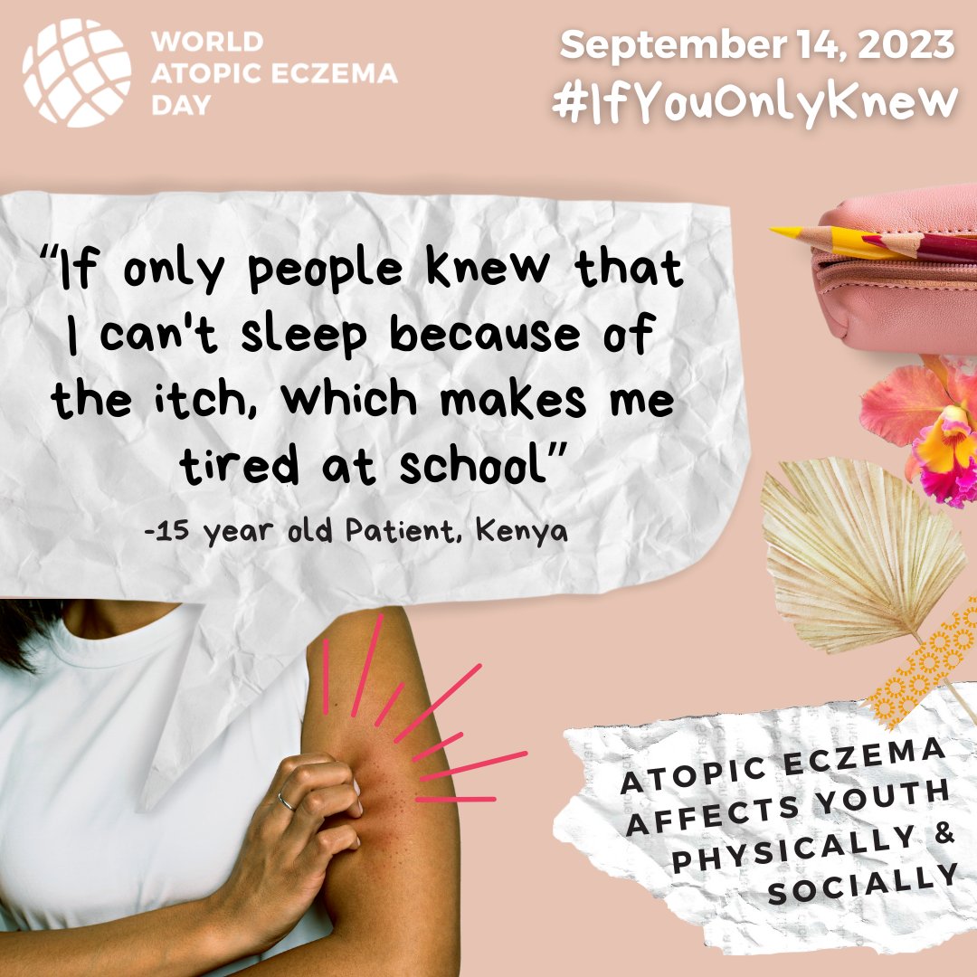 There is a ⤴️ level of frustration for patients w/ #atopiceczema compared to other #skindiseases. Youth struggling with the disease are expected to perform at a regular level (at school &amp; life) because they are perceived to be experiencing "just eczema". globalskin.org/WAED2023