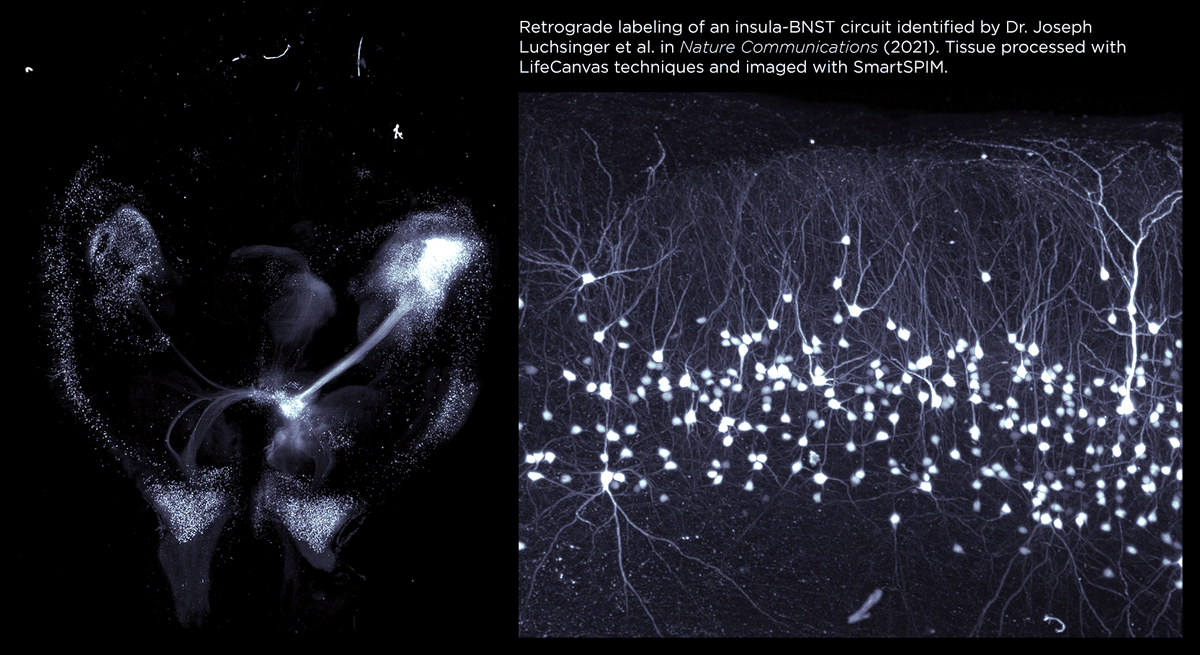Mapping neuronal projections is much faster,  easier, and richer in 3D – see for yourself in this insula-BNST circuit  identified by Dr. <a href="/JoeLuchsinger/">Joe Luchsinger, MD, PhD</a> et al. Experience our 3D circuit mapping workflow in your lab: bit.ly/3PrS0aT
#FluorescenceFriday