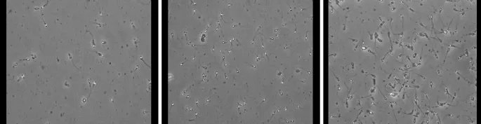 andresvilarino's tweet image. Sperm motility assessed by #deepConvolutionalNeuralNetworks into WHO categories 
#DCNN #ArtificialIntelligence #AI #ML #MachineLearning #DeepLearning #DL #Tech #Technology #Algorithm #Data #NeuralNetwork   
buff.ly/3P2hYR2