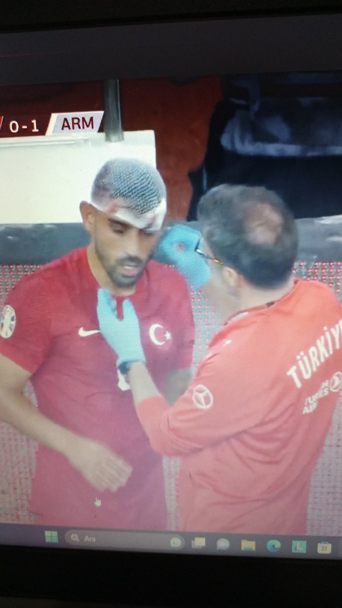 Hakem de Ermeni şu adamın haline bak ya yazık or*spu evlatları 

#TURvARM