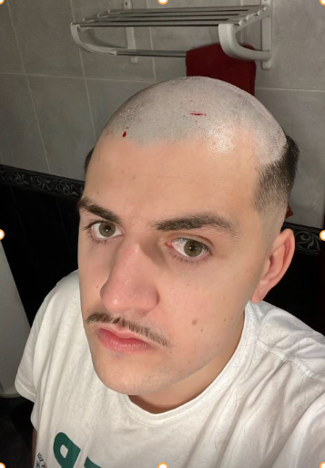 𝙘𝙖𝙡𝙫𝙖𝙤𝙥𝙚𝙚𝙠