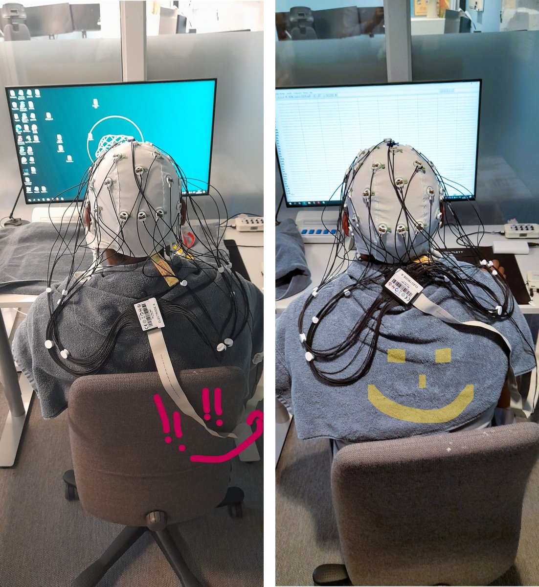 cognitive_co's tweet image. #EEG lab tips

#BrainVision

#electroencephalography