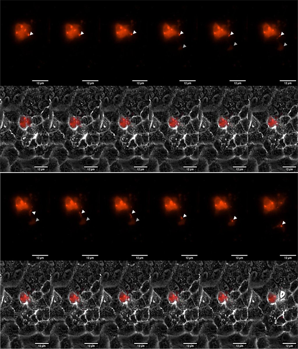 mbiojournal's tweet photo. Human metapneumovirus causes significant morbidity and mortality, particularly in the very young, elderly, and immunosuppressed. This #mBio work provides new information on the formation of filamentous structures that are consistent with virus particles. https://t.co/RYJ5kjryIS https://t.co/BZJU88Fql7