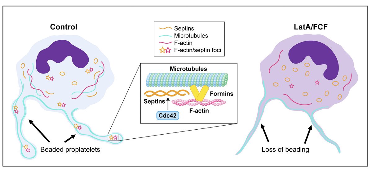 Excited to share our recent paper identifying a role for a new cytoskeletal system – Septins – in platelet production. So proud of @isabellecarlota  driving this to completion.
haematologica.org/article/view/h…