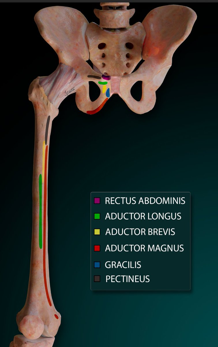 My last job for my lecture at CIRME 2023 online. The origins and insertions of the adductors and rectus abdominis. Always worth remembering.