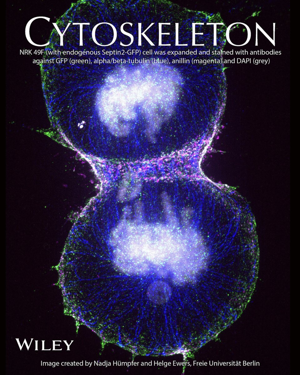 CytoskelJournal's tweet photo. The start of something #new at CYTOSKELETON @CytoskelJournal. The #PICTURE OF THE MONTH! Thanks to Nadja Humpfer and Helge Ewers @ewers_helge for this fantastic image that will be part of a SPECIAL ISSUE on #Septins coming out soon! #cytoskeleton #microtubule #cell #microscopy https://t.co/n9WK6oEw5m