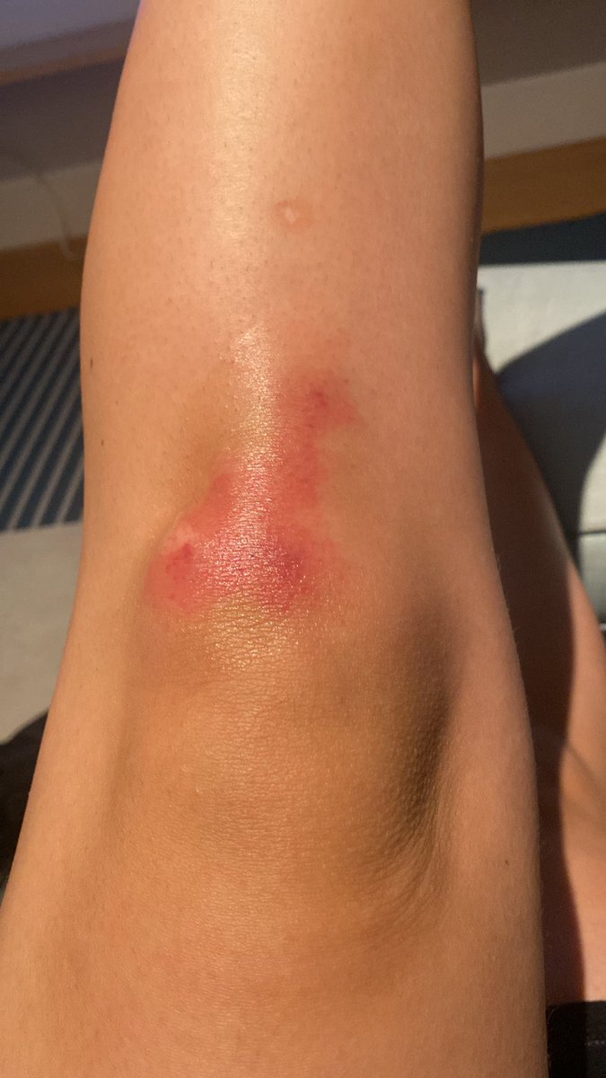MPMontoyaC's tweet photo. Mis rodillas están diciendo que esto de caminar en dos patas al parecer no es lo mío 🫣 https://t.co/uF6OZIKhmo