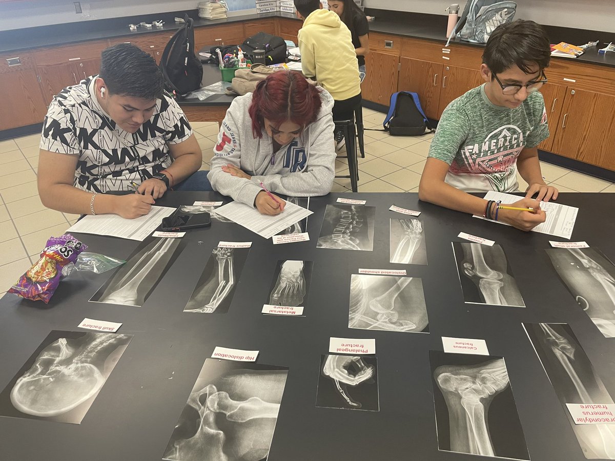 What bone 🦴 is fractured? Let’s check those X-rays 🩻 #drlunasclass #SEHSthebest #SanEliNation #CTEworks #xrays