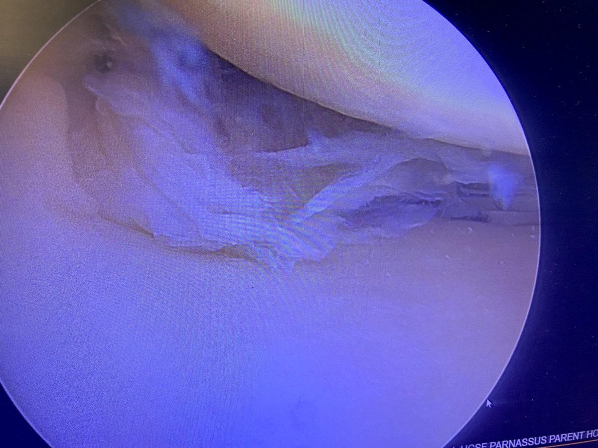 DrNickColyvas's tweet photo. 2 tunnels, 2 months later
Happy patient
#rootrepair https://t.co/Mdi3xFGgTr