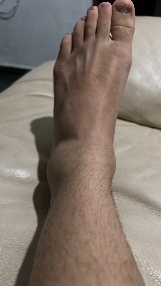 Andrebar777's tweet photo. Dias de luta e dias de luta🤦🏼‍♂️😂😂😂 https://t.co/JUwm15ZYTj