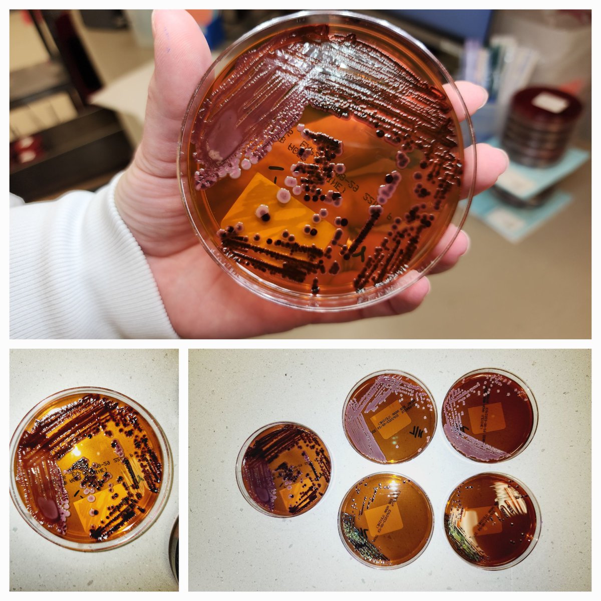 Saadiya Nazli, MD, BSc, QIA(ASCP) tweet media