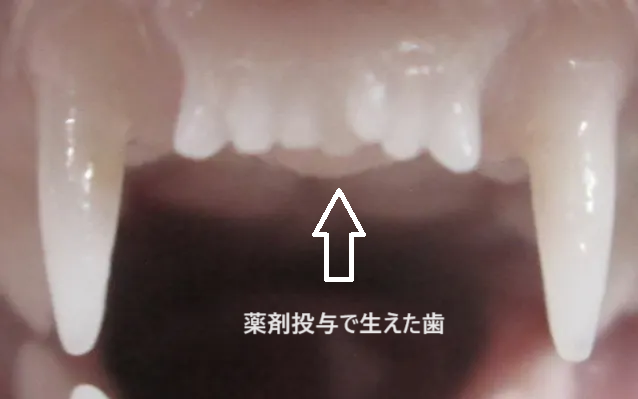 hitsuji_bright's tweet photo. 世界初、「歯を生やす薬」実用化へ

通常、永久歯は一度抜けると一生生えてこない。

これまではインプラントや入れ歯での対応しかなく、新しい歯を生やすことはできなかった。

しかし、この常識が変ろうとしている。京都大学ベンチャーの「トレジェムバイオファーマ」がついに歯を生やす薬を開発した。

2007年、通常よりも多くの歯を持つマウスが偶然見つかり、「USAG-１」というたんぱく質が歯の成長を阻害していることを発見。

この成果を元に「USAG-１」を無効化する抗体薬が開発された。

抗体薬によりUSAG-１を無効化することで、歯の成長が促される。実際にマウスやフェレットでは新たに歯を生やすことに成功している。

2024年から成人を対象に安全性を確かめる治験を開始し、2025年には生まれつき歯がない先天性無歯症の子供を対象に治験が行われる。

実用化は2030年頃になる見込み。

100歳でも歯が20本以上ある。夢のような未来の到来も近い。