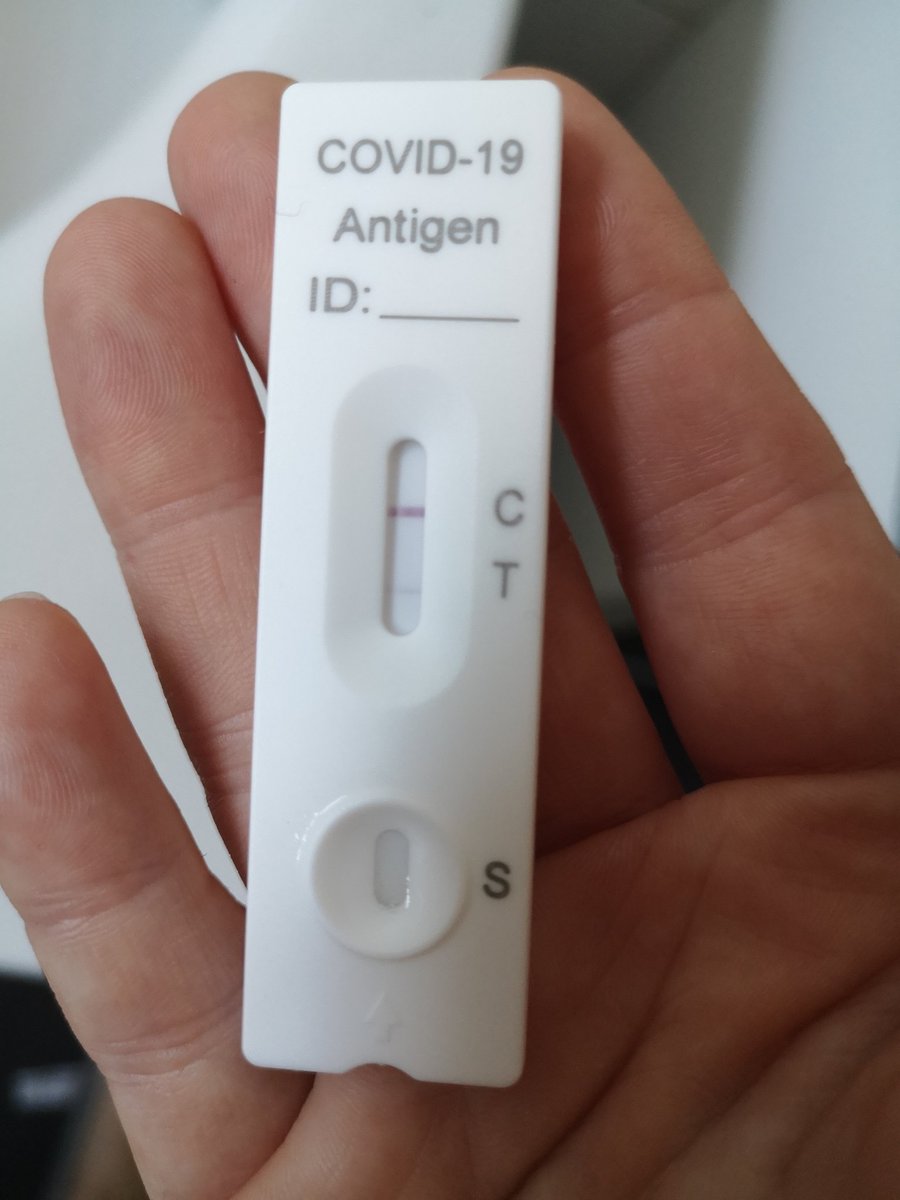 FBergmann_VT's tweet photo. Tag 4, Rebound nach #Paxlovid (Tag 14 nach Erkrankungsbeginn mit #COVID19): Es dauert jetzt länger, bis der Strich sichtbar ist (3 min). Weiter etwas Rotz & Stimme belegt, hab lang geschlafen. Jetzt geht's hoffentlich aufwärts.
#CovidIsNotOver https://t.co/b1ohQUVdGn