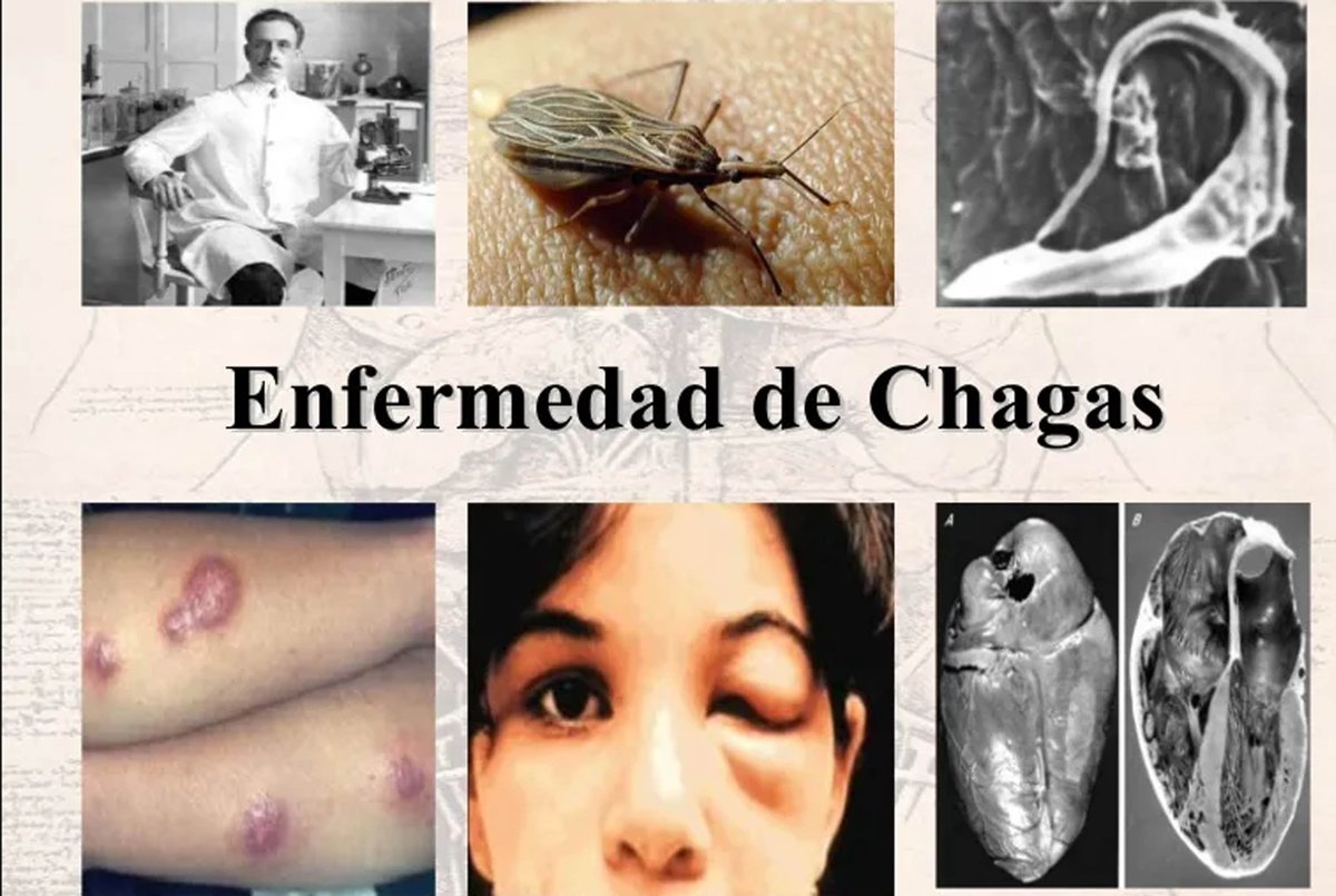 EstebanOrtizMD's tweet photo. ¡Alerta con el Chinche Besucón! 🚫❗ Si bien los besos suelen ser símbolo de amor 😘, el beso de este insecto  puede ser peligroso. 😱 ¿La razón? Es portador del Trypanosoma cruzi y  otros parásitos tripanosomas, causantes de la enfermedad de Chagas. 💔  Protege tu salud y evita el contacto con ellos. 🚷🐜