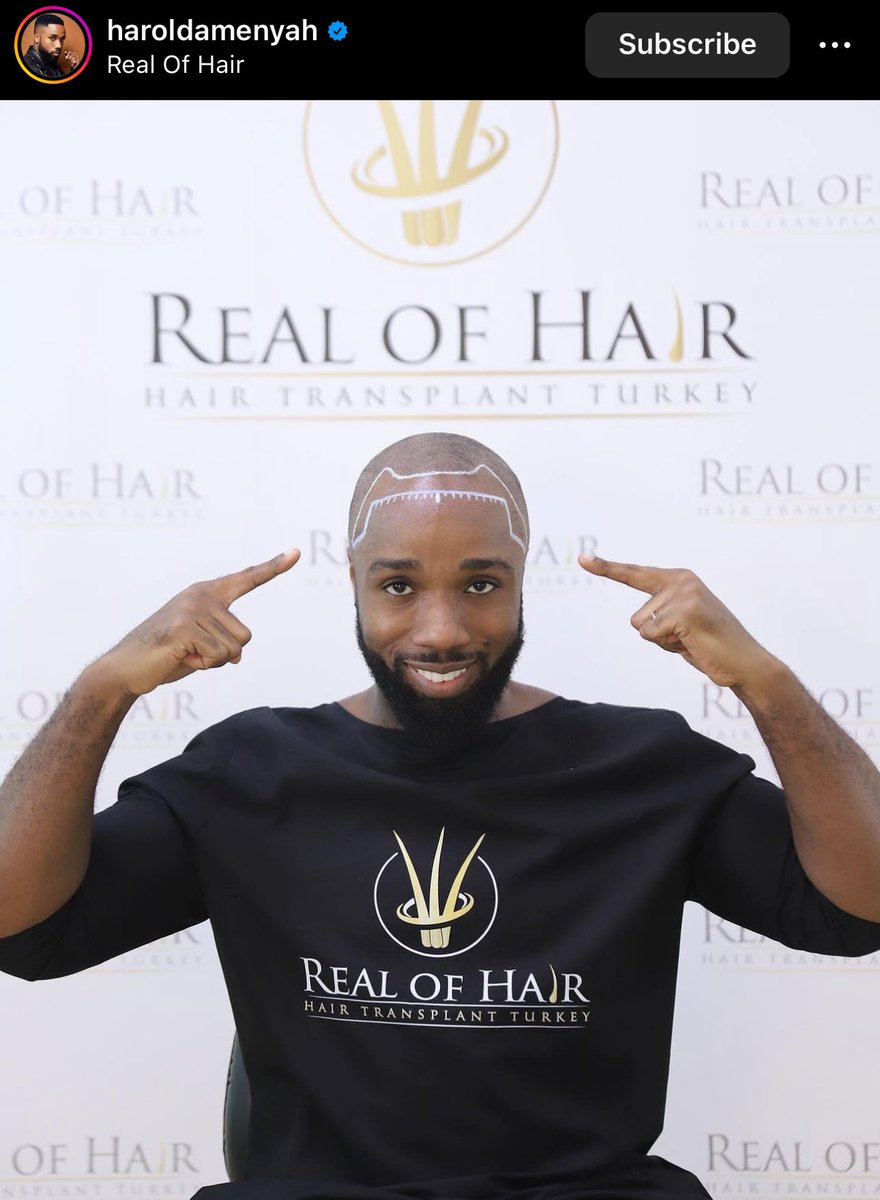 gyaigyimii's tweet photo. Hair transplant mood https://t.co/Mg014PUOqL