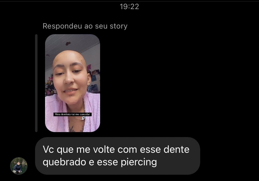 _chalana_'s tweet photo. Coloquei piercing no dente, meu dentista https://t.co/TBRx8ZoCfe