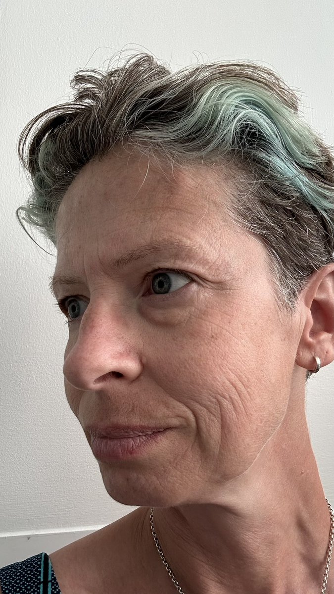 All done. Botox for migraine prevention. And I know now I’m meant to take a huge dose of aspirin 900mg or Ibuprofen (800mg) with a Triptan and metaclopramide when I next get a migraine. Because your stomach stops working most of the NSAID isn’t absorbed which is why you take a