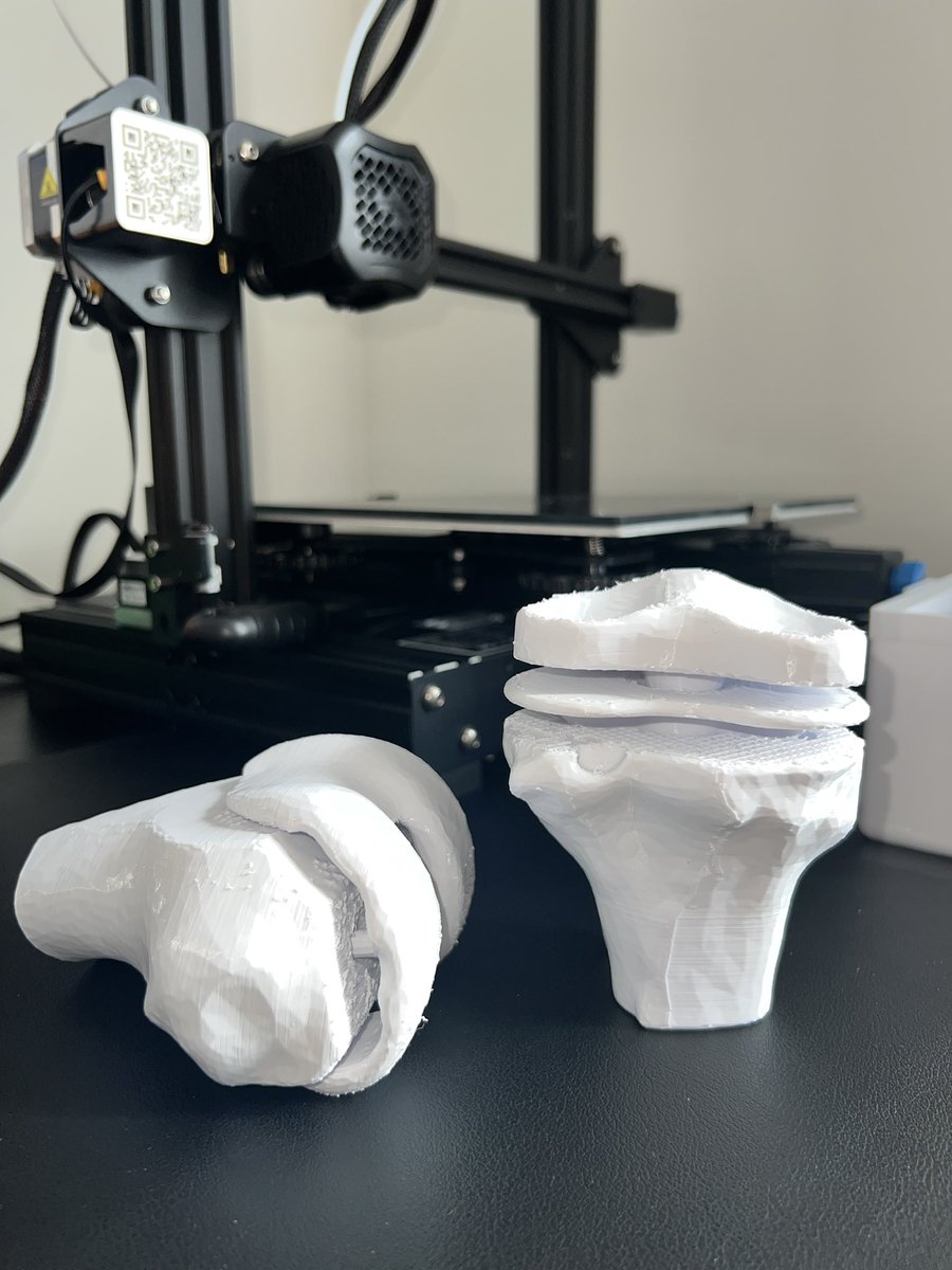Had a lot of fun designing and 3D printing this TKA model! Hopefully it’ll give our patients a better idea of the procedure and implants used! Excited to see how 3D printing can play a larger role in Orthopedic Surgery. 

What I should I print next? 

#orthopedics #hipandknee