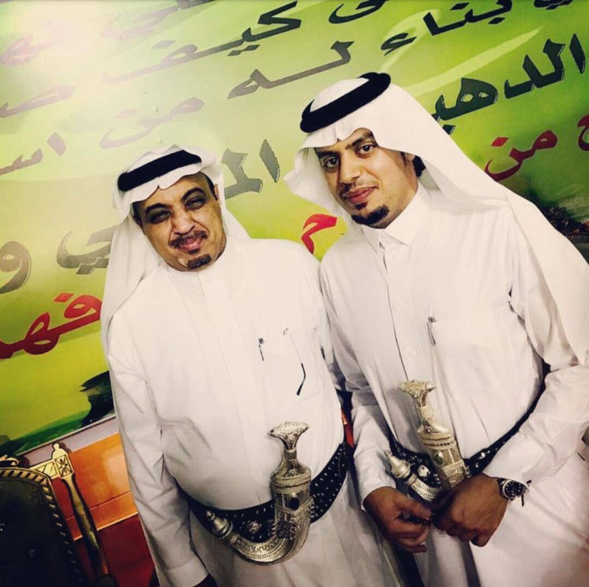 لاباس طهور ان شاء الله شاعرنا الكبير #عبدالله_البيضاني وماتشوف شر ابا ماجد شفاك الله وعافاك