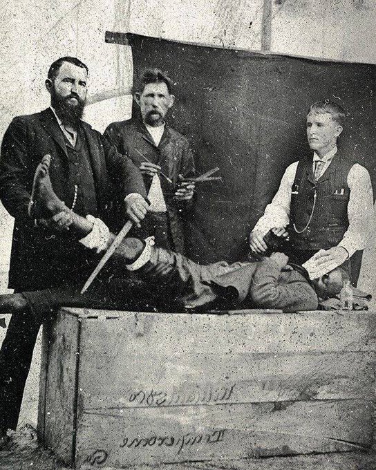 The surgeon and his assistants show the medical commission the effect of ether as an anesthetic during surgery. USA, 1850s.