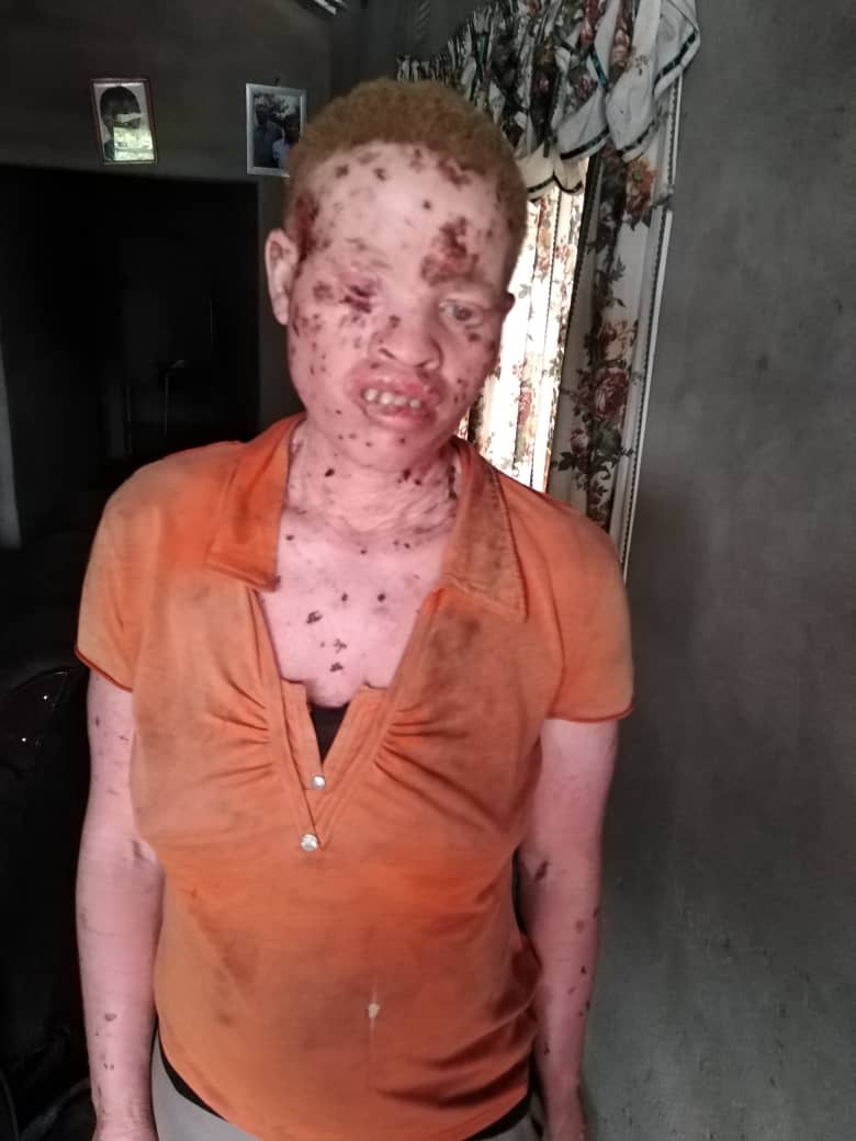 Queen of BaTonga👑 tweet media