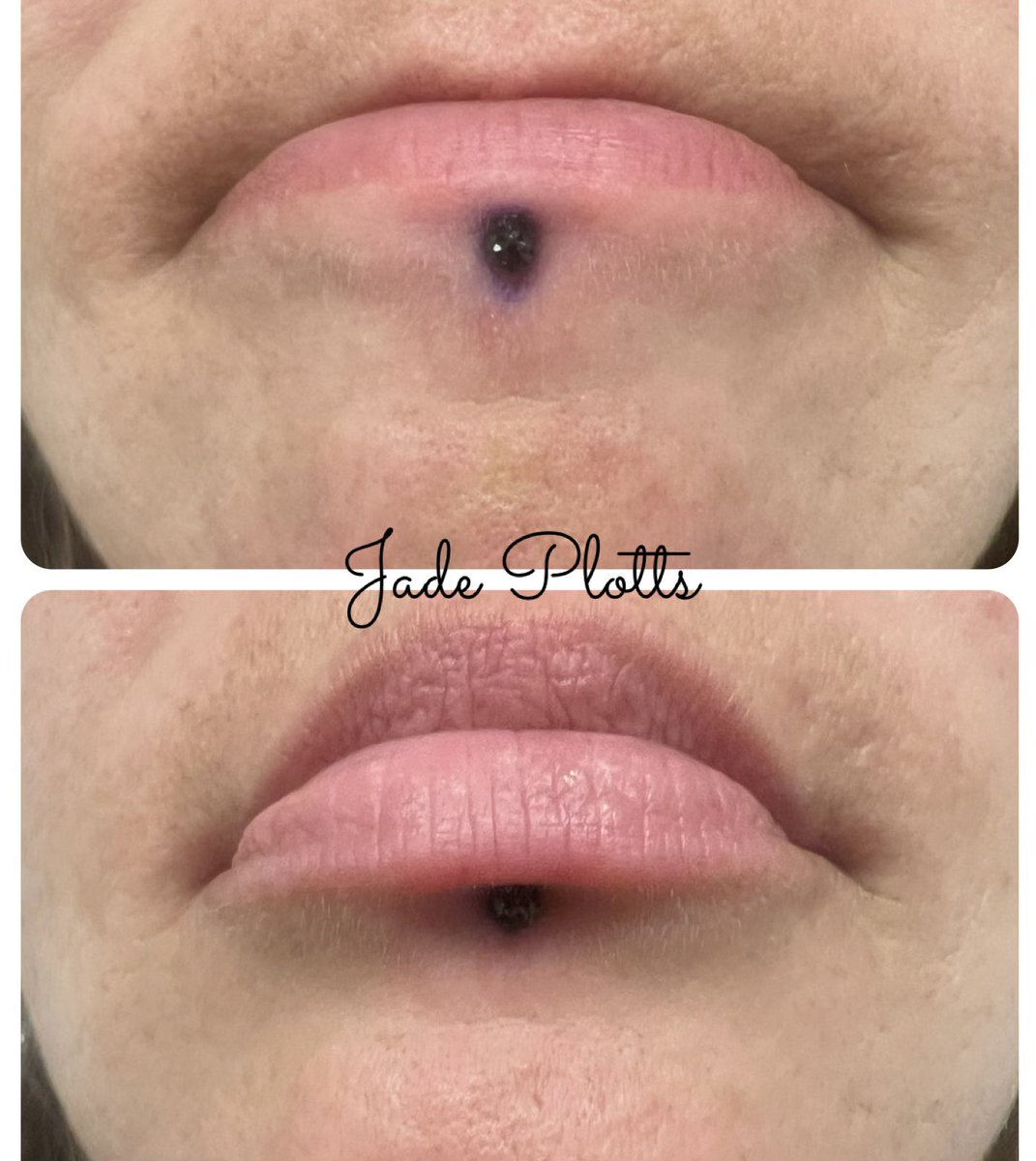 mpwinnermp's tweet photo. Piercings done today at https://t.co/8p6jcz0KCn located in Lewisburg!! #piercing #pmu #tattoo https://t.co/8EhiG9AmCY