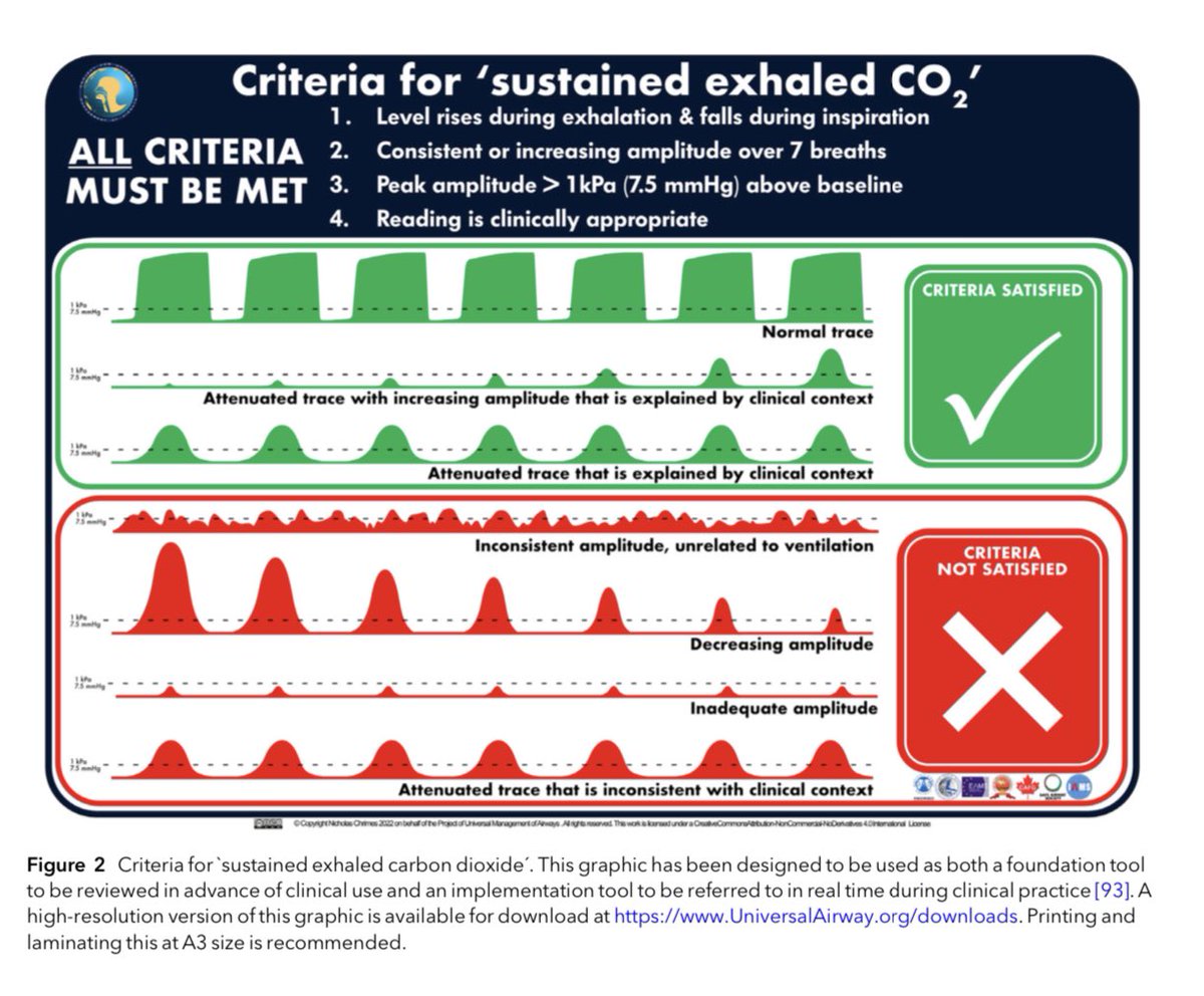 doctimcook's tweet photo. @DrEddFinn @AndyHiggsGAA @Fionafionakel @NicholasChrimes @RCoANews I’m not sure it’s that simple
As well as “no trace, wrong place” we need to have in mind “poor trace, wrong place”

Or rather “lack of sustained exhaled capnography”
≠
-trace rises &amp; falls with ventilation
-sustained
- > 1KPa
-clinically ok

This may be as common as “flat trace” https://t.co/8uTOFY7y3Q