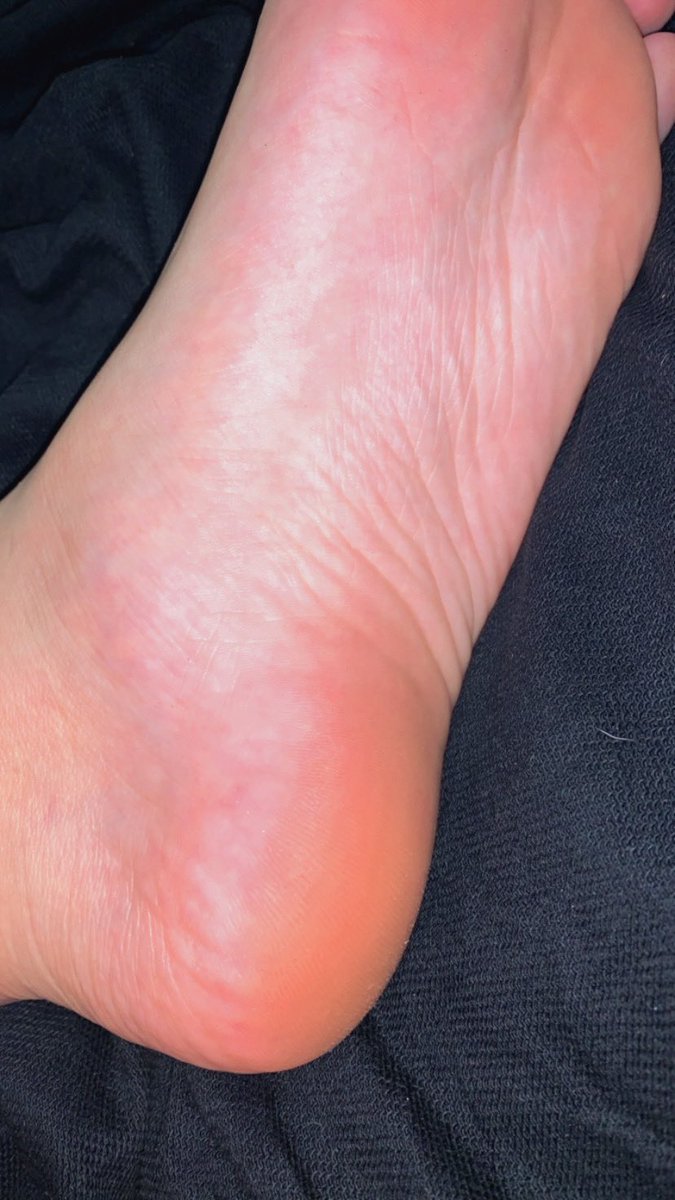 packsmanu_'s tweet photo. oii gente, estou vendendo fotinhas do meu pé! caso se interessem podem me chamar que eu passo os preços (a partir de 5 reais) 🦶🏻🩷✨
#packdopé #vendopés #feet_pic #feetcontent #feetbrazil #packdopezinho #packs #packfeets #podolatria #podolatra #solas #soladopé 🔥 https://t.co/FCgGlsaX2e