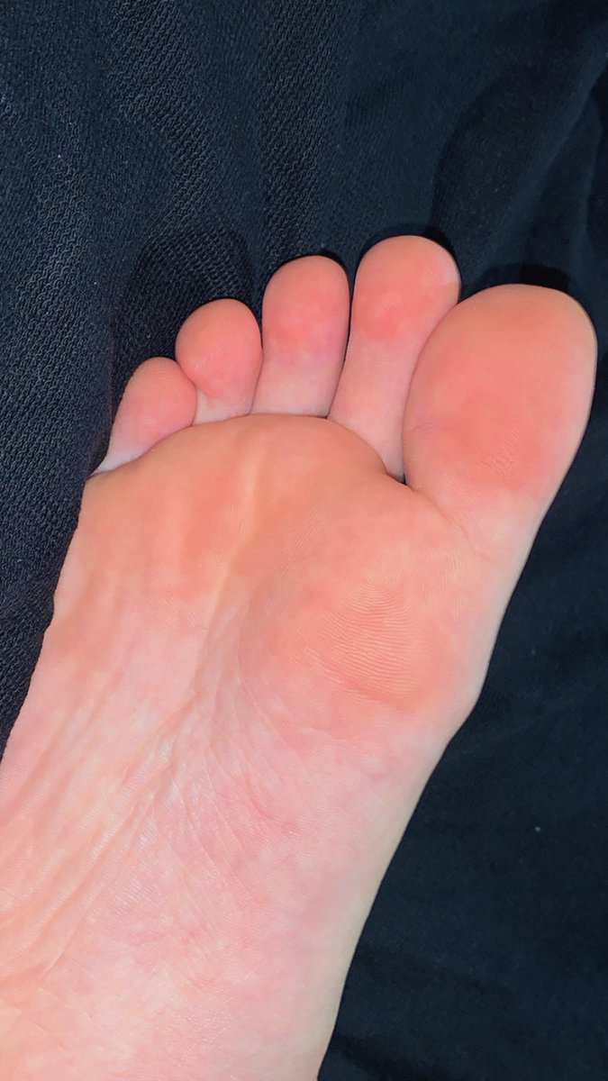 packsmanu_'s tweet photo. oii gente, estou vendendo fotinhas do meu pé! caso se interessem podem me chamar que eu passo os preços (a partir de 5 reais) 🦶🏻🩷✨
#packdopé #vendopés #feet_pic #feetcontent #feetbrazil #packdopezinho #packs #packfeets #podolatria #podolatra #solas #soladopé 🔥 https://t.co/FCgGlsaX2e