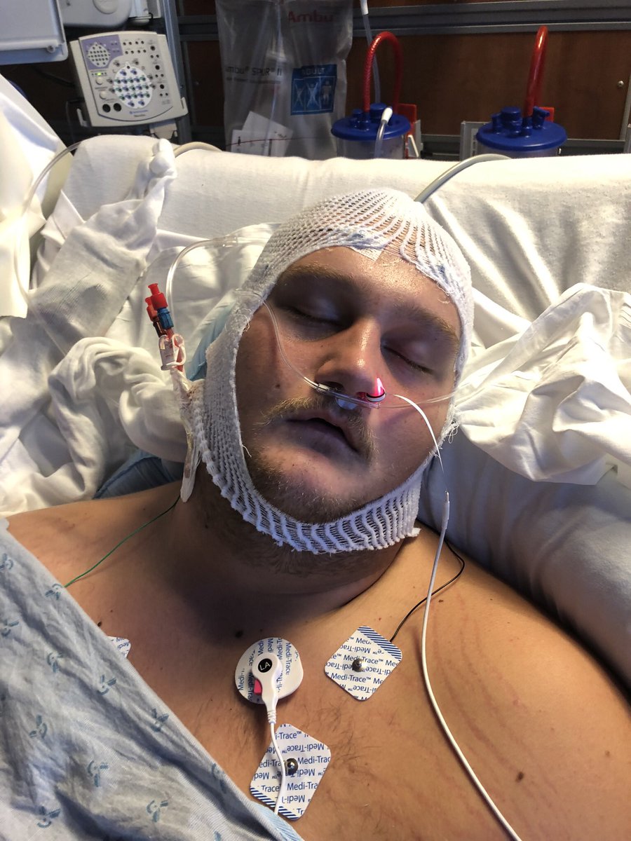 KurtLofye's tweet photo. One year ago @KLofye was fighting for his life. Tonight he played and started in his first D1 Football game. We are proud of the work you put in to get back on the field. @Lion_Athletics https://t.co/m8mDJRQ42H