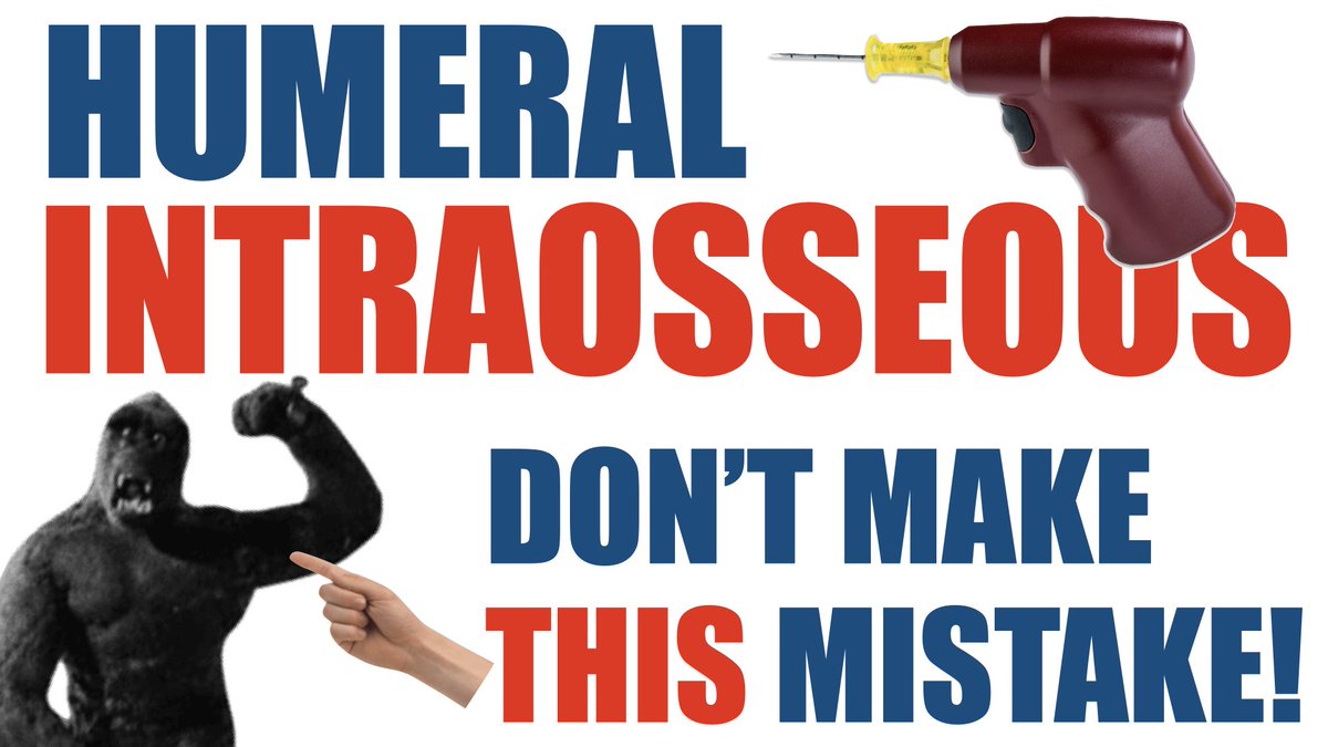 Humeral intraosseous access is our favourite go-to for immediate vascular access when venous access is delayed

But moving the arm to allow other procedures eg. thoracostomy can deform the needle or dislodge it

Here's how to prevent it

Video 5 min 40 sec
youtu.be/3L5vSKyqi6w