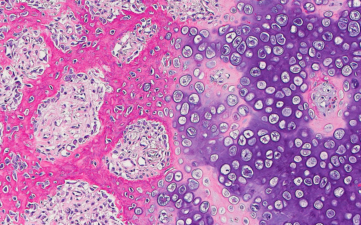 Cartilage and Woven Bone ~ Duo 🔴🟣 #PathArt