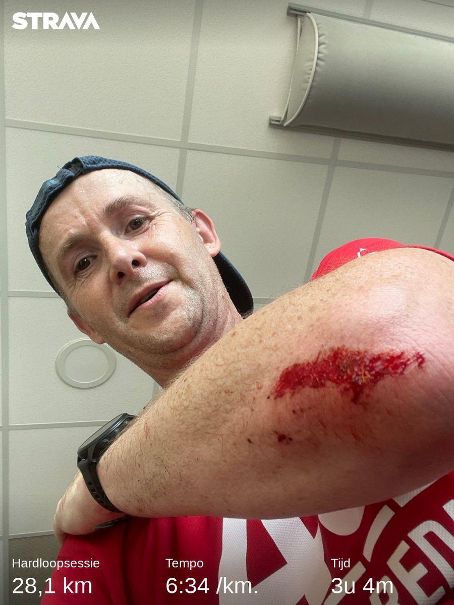 Bloed, veel zweet en geen vocht over voor tranen ⁦<a href="/loopmaatjes/">Loopmaatjes</a>⁩  . 33km training was te veel. 26km vonden mijn benen genoeg. 2km wandelen. Voldaan. Volg mijn training voor ⁦<a href="/40vanBreda/">40 van BREDA</a>⁩ voor ⁦<a href="/SingelloopBreda/">Singelloop Breda</a>⁩ op Strava.
strava.app.link/NO764B8GYCb