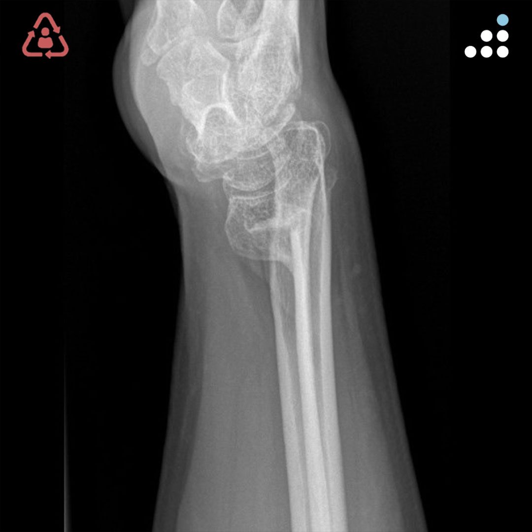 Orthobullets tweet media