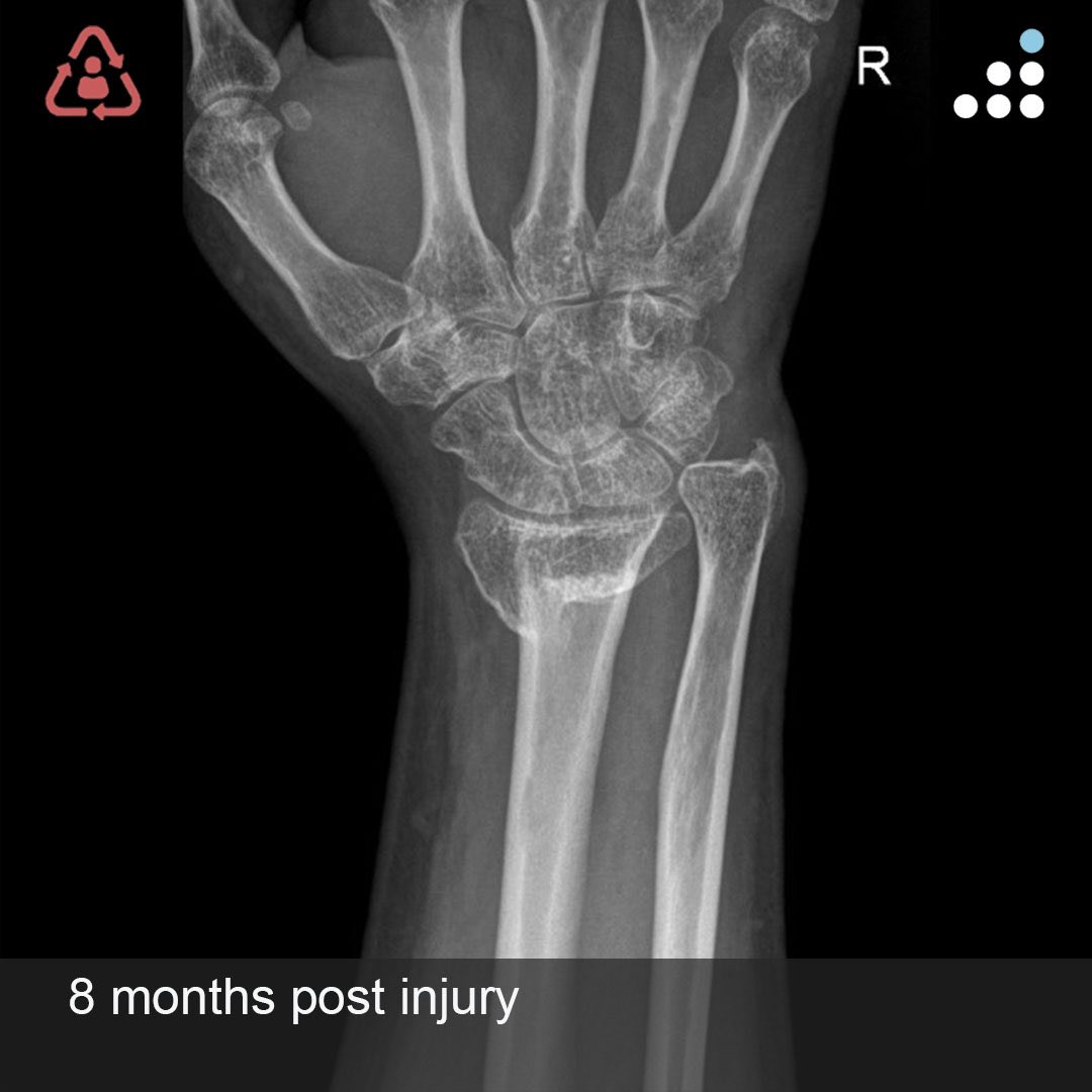 Orthobullets tweet media