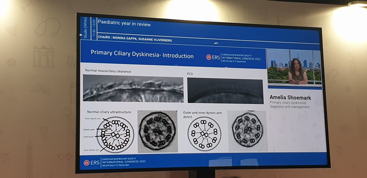 _Claire_Jackson's tweet photo. @beatpcd @Shoemelia gives a fantastic overview of the current state of #pcd Multiple tests (see ERS/ATS 2017 guidelines) needed because no single test will diagnose all PCD cases. Look at standards. 1:7500, 56 genes. Don't misdiagnose. Don't miss diagnoses #beatpcd #ERSCongress https://t.co/3AO5Xak8ye